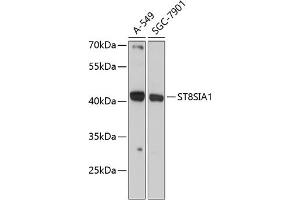 Western blot analysis of extracts of various cell lines, using ST8SI antibody (ABIN6132687, ABIN6148541, ABIN6148542 and ABIN6225056) at 1:3000 dilution. (ST8SIA1 antibody  (AA 49-270))