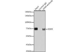 Immunoprecipitation analysis of 200 μg extracts of HeLa cells using 3 μg SOX9 antibody (ABIN7270577). (SOX9 antibody)
