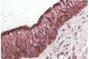 AP20183PU-N ALDH3A1 antibody staining of paraffin embedded Human Lung at 3. (ALDH3A1 antibody  (C-Term))