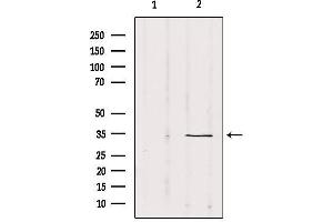 Western blot analysis of extracts from Mouse Myeloma cell, using SOX12 Antibody.