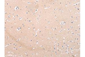The image on the left is immunohistochemistry of paraffin-embedded Human brain tissue using ABIN7193105(ZNF106 Antibody) at dilution 1/20, on the right is treated with synthetic peptide. (ZNF16 antibody)