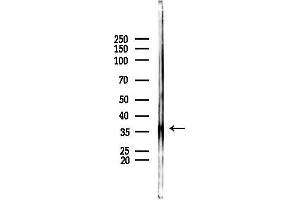 anti-Arginase, Liver (ARG1) (C-Term) antibody