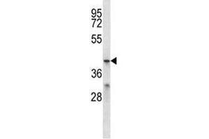 MFSD2B antibody western blot analysis in ZR-75-1 lysate. (MFSD2B antibody  (AA 383-411))