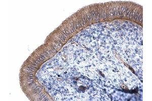 IHC-P Image Alpha-catulin antibody [N3C2], Internal detects Alpha-catulin protein at cytoplasm on mouse cervix by immunohistochemical analysis.