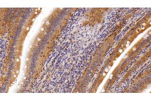 Detection of LPL in Rat Small intestine Tissue using Polyclonal Antibody to Lipoprotein lipase (LPL) (Lipoprotein Lipase antibody  (AA 28-474))