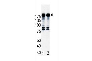 Western blot analysis of ErbB2 (arrow) in T47D cell lysates, either noninduced (Lane 1) or induced with HRG (Lane 2). (ErbB2/Her2 antibody  (N-Term))