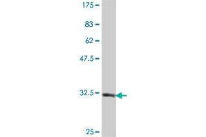 Western Blot detection against Immunogen (33. (NAGK antibody  (AA 1-69))