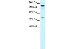 WB Suggested Anti-NFKBIB Antibody Titration:  1. (NFKBIB antibody  (N-Term))