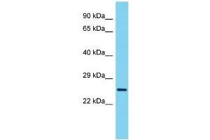 Host: Rabbit Target Name: VCX3A Sample Type: ACHN Whole Cell lysates Antibody Dilution: 1. (VCX3A antibody  (N-Term))
