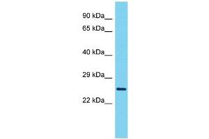 Host: Rabbit Target Name: VCX3A Sample Type: ACHN Whole Cell lysates Antibody Dilution: 1.