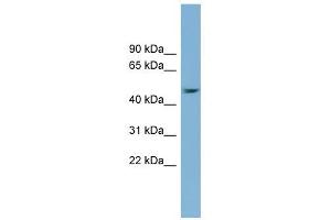SERPINB1 antibody used at 1 ug/ml to detect target protein.