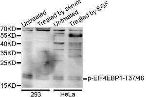 Western blot analysis of extracts of various cells, using Phospho-EIF4EBP1-T37/46 antibody (ABIN5995638). (eIF4EBP1 antibody  (pThr36))