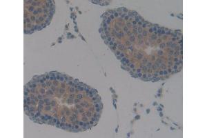 Figure. (ANGPTL2 antibody  (AA 141-308))