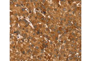 Immunohistochemistry (IHC) image for anti-TBC1 (Tre-2/USP6, BUB2, Cdc16) Domain Family, Member 1 (TBC1D1) antibody (ABIN2433984) (TBC1D1 antibody)