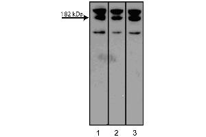 Western blot analysis of AF6 on a PC-12 cell lysate (Rat neuroblastoma, ATCC CRL-1721).