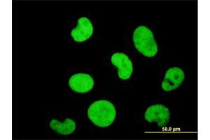 Immunofluorescence of monoclonal antibody to ZNF207 on HeLa cell. (ZNF207 antibody  (AA 1-110))