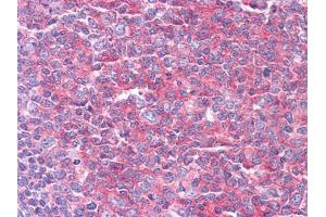 Immunohistochemical analysis of paraffin-embedded human Tonsil tissues using KARS mouse mAb (KARS antibody  (AA 90-174))