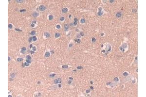 Detection of CPR in Human Cerebrum Tissue using Polyclonal Antibody to Cytochrome P450 Reductase (CPR) (POR antibody  (AA 77-518))
