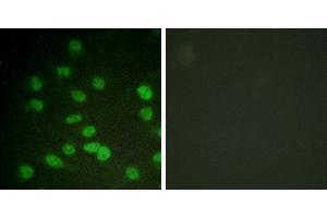 serum + -Immunohistochemistry analysis of paraffin-embedded human brain tissue using DDX3/DEAD-box Protein 3 (Phospho-Thr322) antibody. (DDX3 antibody  (pThr322))