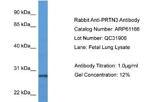 Western Blotting (WB) image for anti-Proteinase 3 (PRTN3) (N-Term) antibody (ABIN2788703) (PRTN3 antibody  (N-Term))