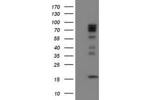 Image no. 1 for anti-CCR4-NOT Transcription Complex Subunit 4 (CNOT4) (AA 190-455) antibody (ABIN1491105) (CNOT4 antibody  (AA 190-455))