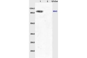 Lane 1: mouse liver lysates Lane 2: mouse lung lysates probed with Anti Phospho-TrkA (Tyr490) /TrkB (Tyr516) Polyclonal Antibody, Unconjugated (ABIN746603) at 1:200 in 4 °C. (TRKA antibody  (pTyr496))