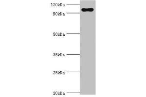 Western blot All lanes: TGS1 antibody at 10 μg/mL + Mouse skeletal muscle tissue Secondary Goat polyclonal to rabbit IgG at 1/10000 dilution Predicted band size: 97 kDa Observed band size: 97 kDa (TGS1 antibody  (AA 714-853))