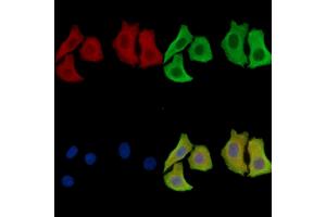ABIN7097011 and ABIN7101078 staining Hela cells by IF/ICC.