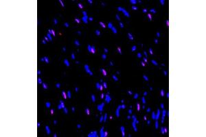 Immunofluorescence of paraffin embedded rat heart using SOCS7 (ABIN7075765) at dilution of 1:650 (300x lens)