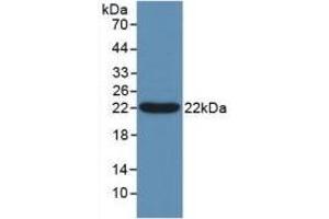 Detection of Recombinant Bcl2L2, Human using Polyclonal Antibody to B-Cell CLL/Lymphoma 2 Like Protein 2 (Bcl2L2) (BCL2L2 antibody  (AA 2-193))
