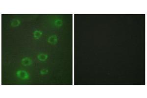 Immunofluorescence (IF) image for anti-Pentraxin 3 (PTX3) (N-Term) antibody (ABIN1849270)