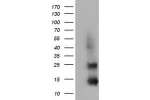 Western Blotting (WB) image for anti-Follicle Stimulating Hormone, beta Polypeptide (FSHB) antibody (ABIN1498317)