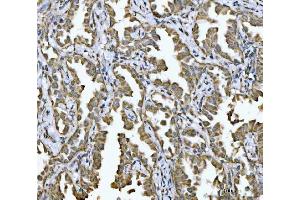 IHC analysis of NDUFV2 using anti-NDUFV2 antibody (ABIN7599154). (NDUFV2 antibody  (AA 1-249))