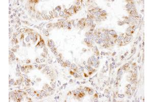 Immunohistochemistry (IHC) image for anti-Propionyl CoA Carboxylase, alpha Polypeptide (PCCA) (AA 678-728) antibody (ABIN7454579)