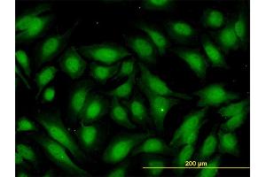 Immunofluorescence of monoclonal antibody to RBBP9 on HeLa cell. (RBBP9 antibody  (AA 87-185))