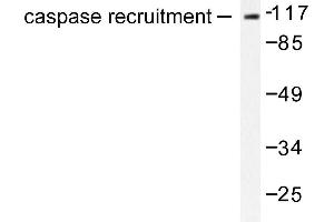 Image no. 1 for anti-Caspase Recruitment Domain Family, Member 6 (CARD6) antibody (ABIN265333) (CARD6 antibody)