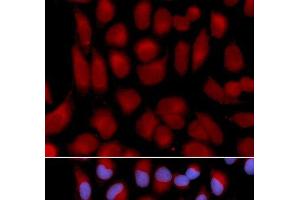 Immunofluorescence analysis of U2OS cells using TAP2 Polyclonal Antibody