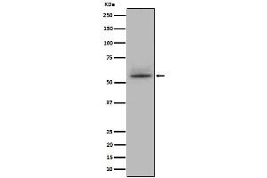 Western blot analysis of CD147 expression in Jurkat cell lysate. (Recombinant CD147 antibody)