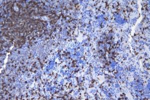 IHC analysis of CD5 using anti-CD5 antibody (ABIN7600839).