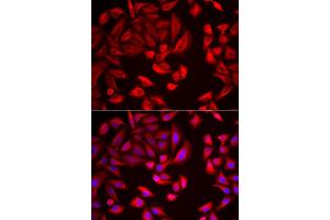 Immunofluorescence analysis of HeLa cell using CCT2 antibody. (CCT2 antibody)