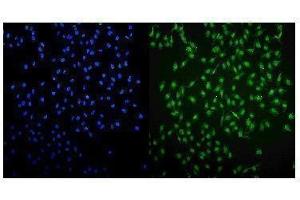anti-Ubiquitin-Like, Containing PHD and RING Finger Domains, 1 (UHRF1) (AA 14-51), (N-Term) antibody