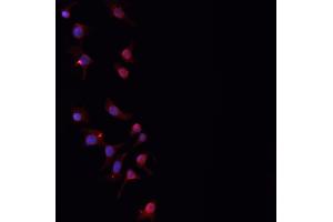 ABIN6276842 staining HepG2? (PLGF antibody  (Internal Region))