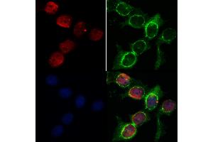 ABIN6263204 and ABIN6268937 staining HepG2 by IF/ICC.