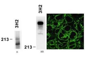 Reactivity of laminin alpha4 chain specific monoclonal antibody 3H2 on human platelet lysate by Western blotting (reducing, R and nonreducing, NR conditions) and on human embryonic kidney preparation (LAMa4 antibody)
