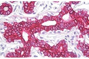 Anti-Cytokeratin 8 / Keratin 8 antibody IHC staining of human breast. (KRT8 antibody  (AA 434-483))