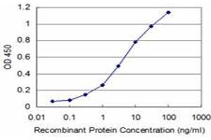 Detection limit for recombinant GST tagged RCV1 is approximately 0. (Recoverin antibody  (AA 101-199))