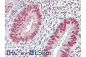 IHC-P analysis of Human Uterus Tissue, with HE staining. (Nucleolin antibody  (AA 388-569))