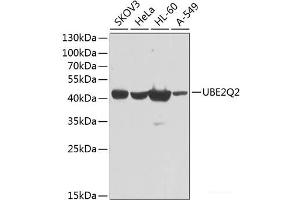 Western blot analysis of extracts of various cell lines using UBE2Q2 Polyclonal Antibody at dilution of 1:1000. (UBE2Q2 antibody)