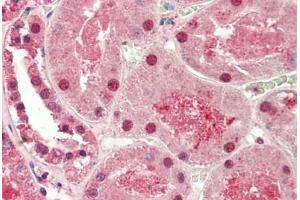 Human Kidney: Formalin-Fixed, Paraffin-Embedded (FFPE) (ST8SIA2 antibody  (AA 295-344))