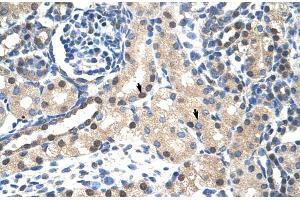 Rabbit Anti-STAT1 Antibody  Paraffin Embedded Tissue: Human Kidney Cellular Data: Epithelial cells of renal tubule Antibody Concentration: 4. (STAT1 antibody  (N-Term))